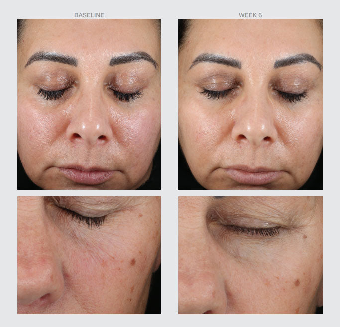 Perfect Retinol Serum