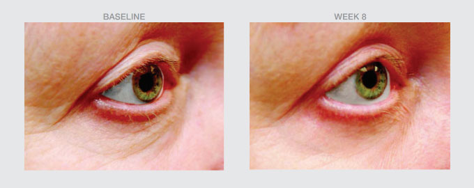 Eye Rehab