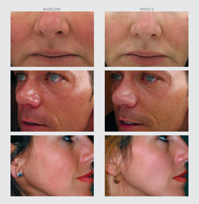Antioxidant Serum
